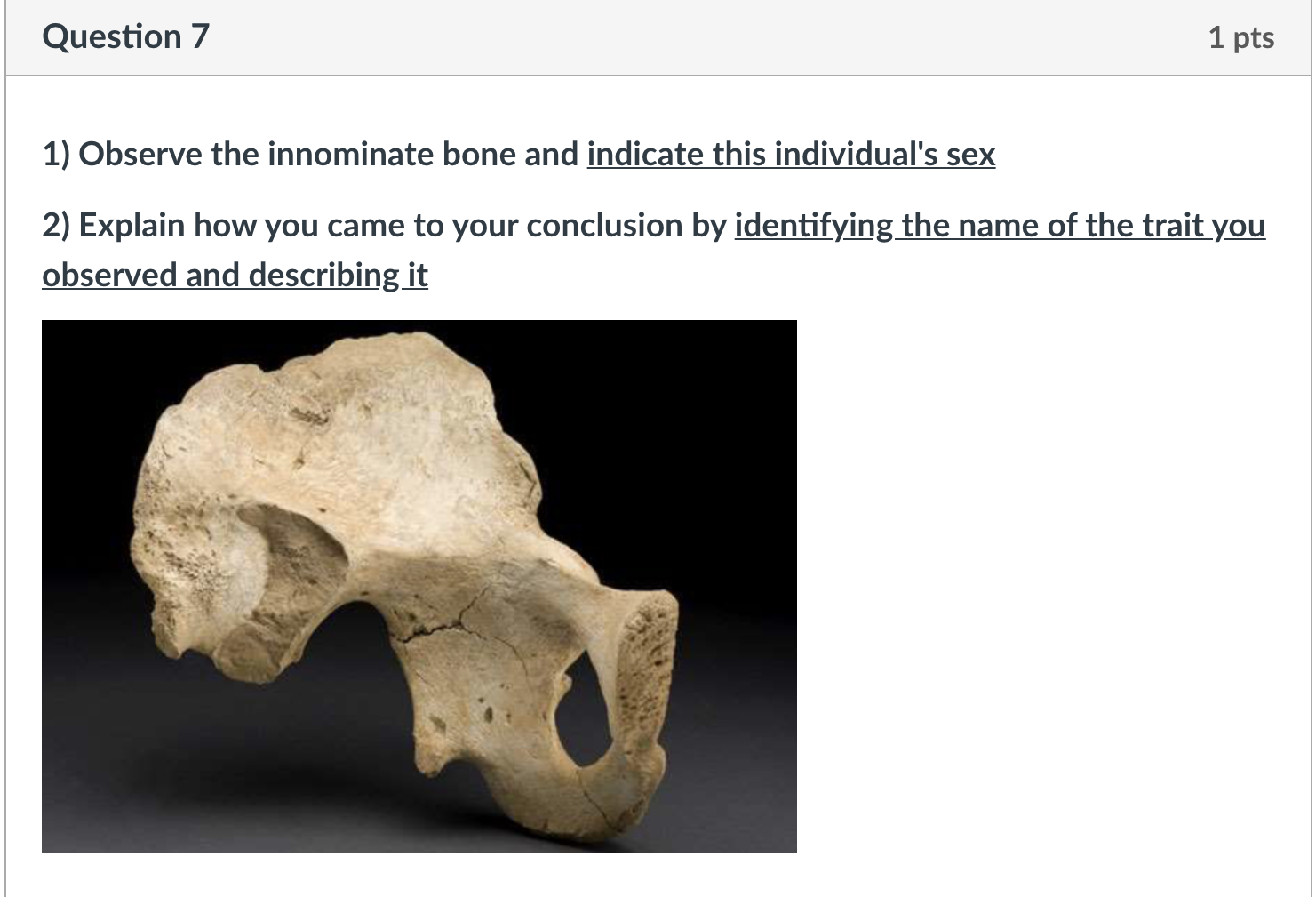 Solved Question 8 1 pts 1) Observe the innominate bone and | Chegg.com