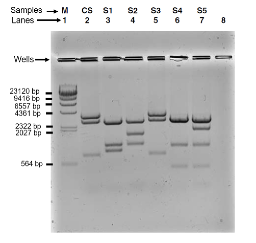 Solved Which sample has the smallest DNA fragment Which DNA