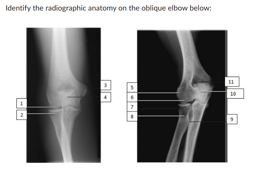 Solved Identify The Radiographic Anatomy On The Oblique 1242