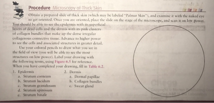 Solved Procedure Microscopy of Thick Skin obtain a prepared | Chegg.com