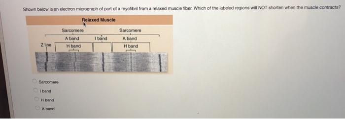 Solved Shown below is an electron micrograph of part of a | Chegg.com