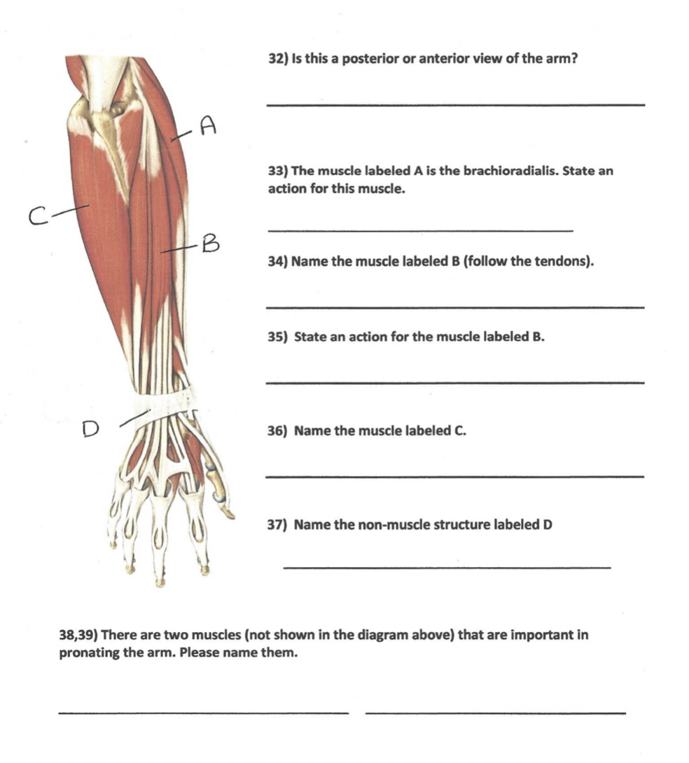 Solved 32 Is This A Posterior Or Anterior View Of The Ar Chegg Com