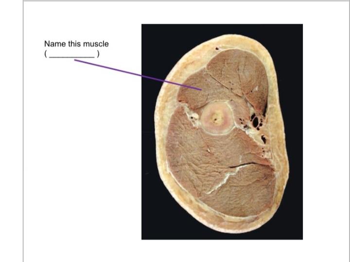 Solved Name this muscle Name this muscle Name this | Chegg.com