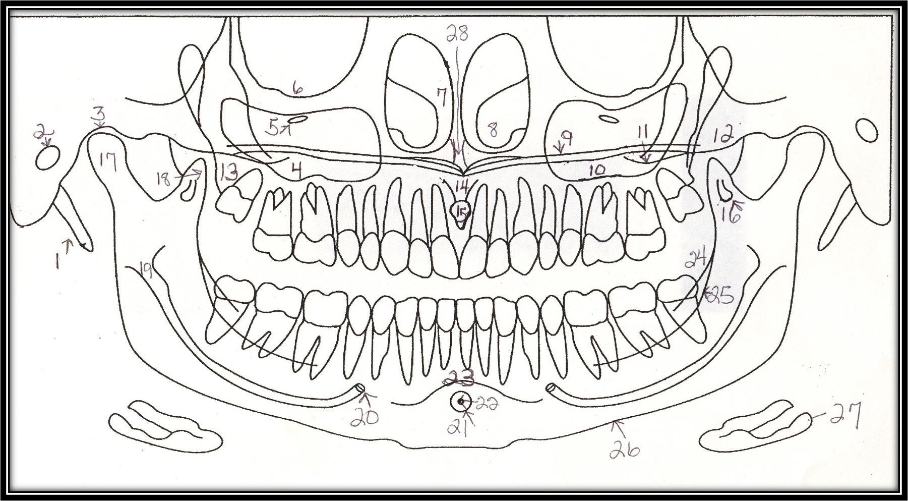 Solved Label the Following image of Normal Anatomic | Chegg.com