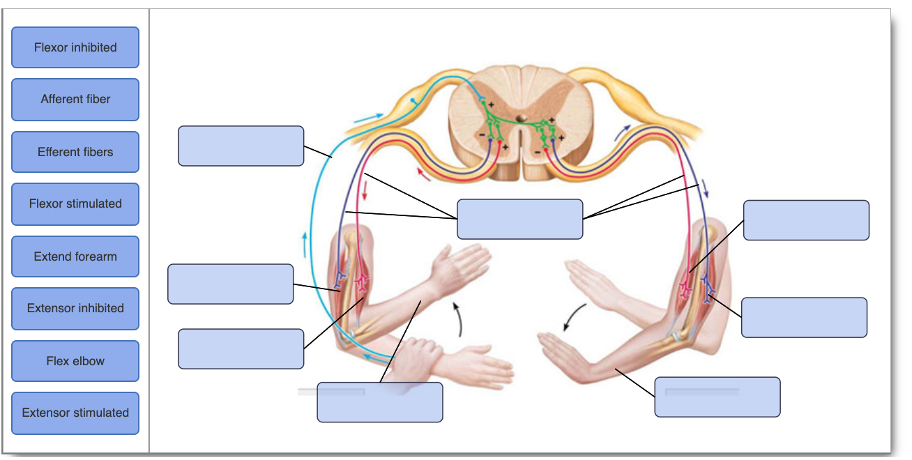 Solved: Review The Neural Pathways Of The Crossed Extensor... | Chegg.com