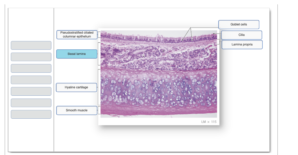 Solved Goblet cells Pseudostratified ciliated columnar