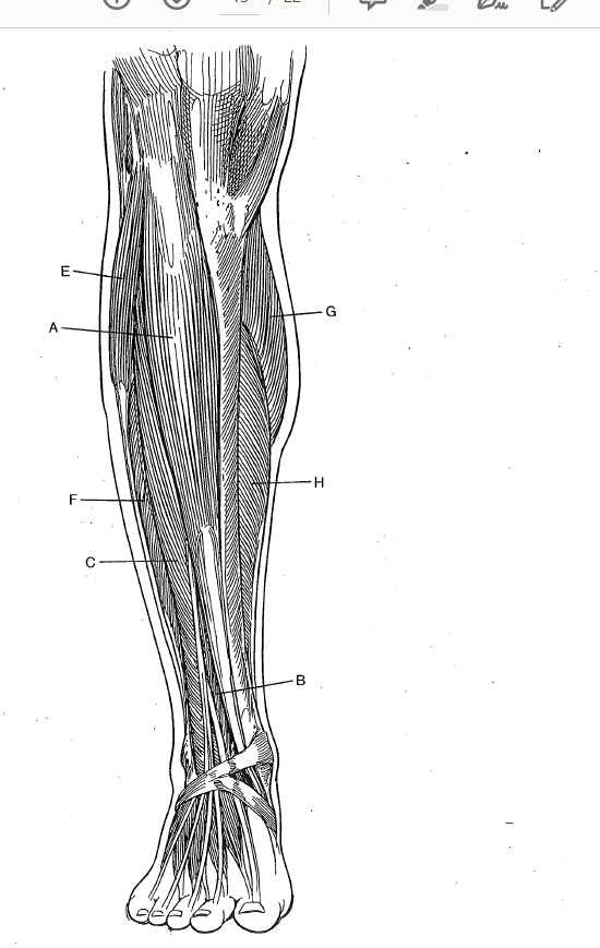 Solved Label each muscle and give the Origin, Insertion, | Chegg.com