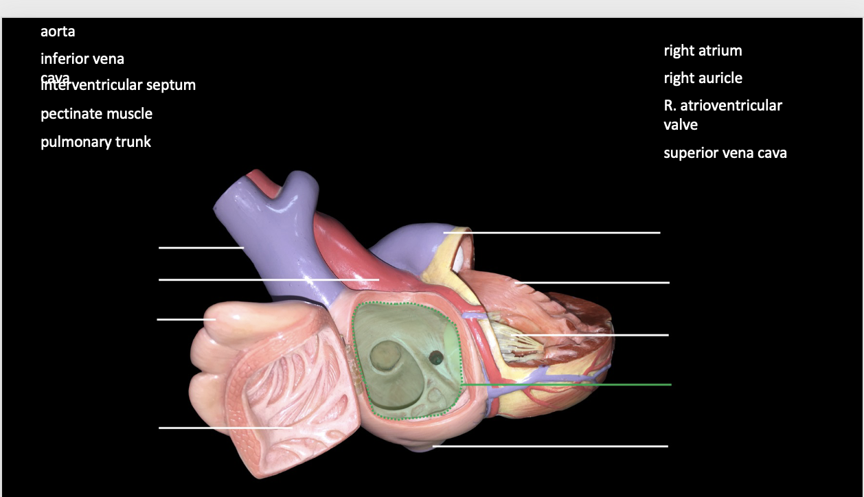 Solved Please label the heart with the labels provided. | Chegg.com