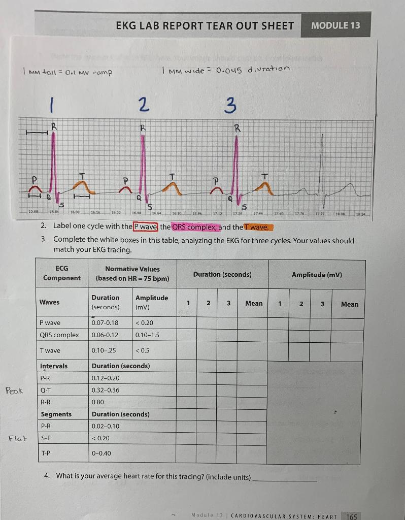 Solved EKG LAB REPORT TEAR OUT SHEET MODULE 13 Imm tall =