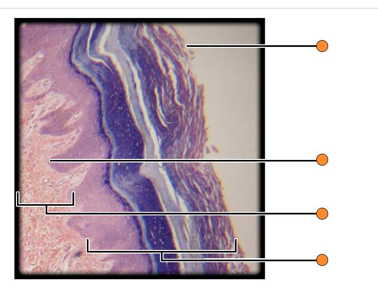 Solved Identify stratified squamous epithelial tissue | Chegg.com