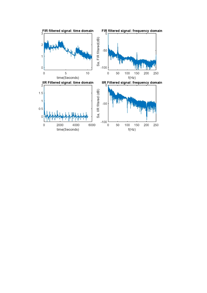 SEE THE ECG signal before and after filtering both | Chegg.com