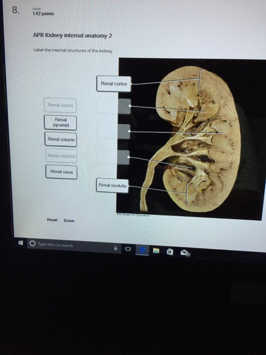 Solved: APR Kidney Internal Anatomy 2 Label The Internal S... | Chegg.com