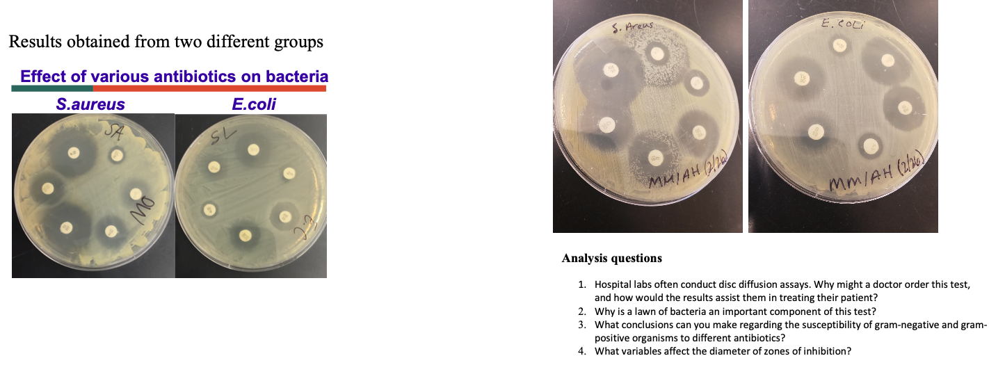 Empiric - antibiotic card game on X: When you hear the e coli is pan  susceptible  / X