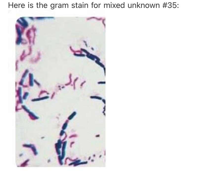 Solved Here is the gram stain for mixed unknown \#35: | Chegg.com