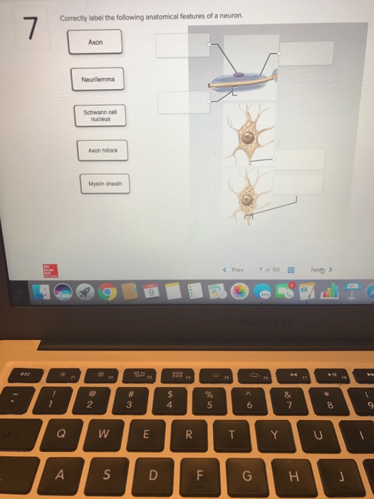 Solved Correctly label the following anatomical features of | Chegg.com