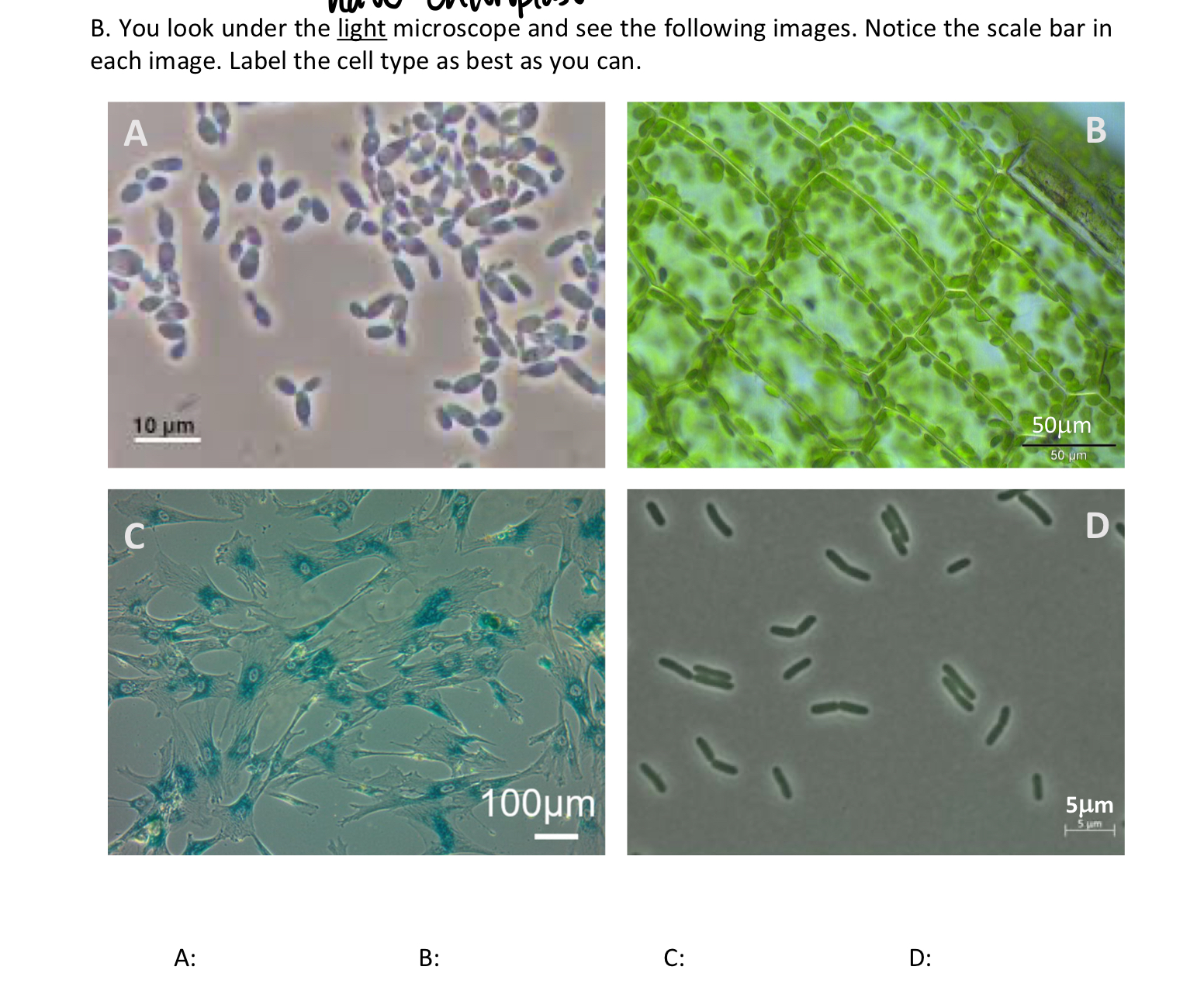 B. ﻿You look under the light microscope and see the