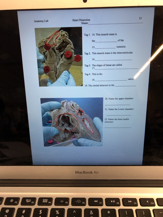 Solved 12 Heart Dissection Anatomy Lab Tag 1. 14. This