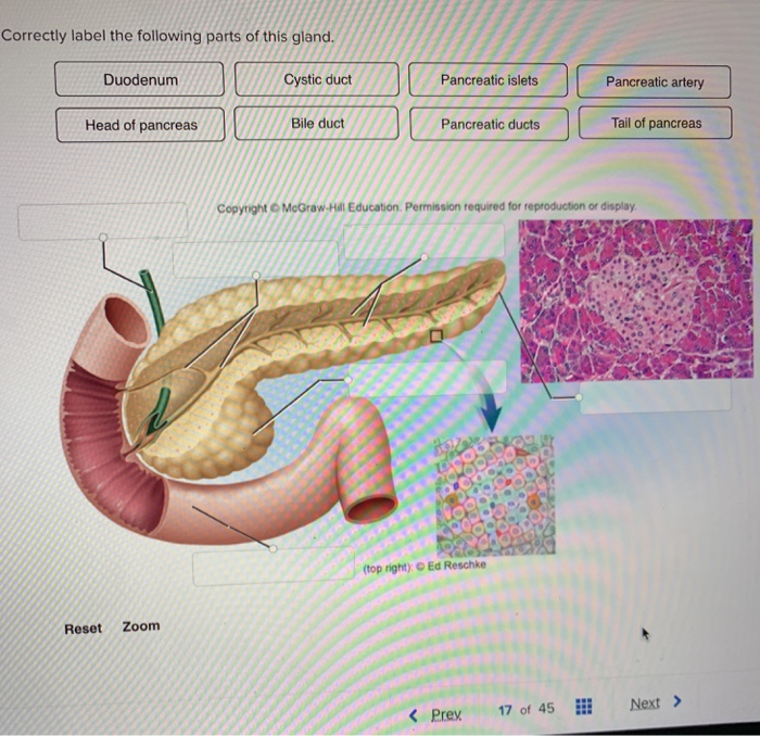 Solved: Correctly Label The Following Parts Of This Gland | Chegg.com