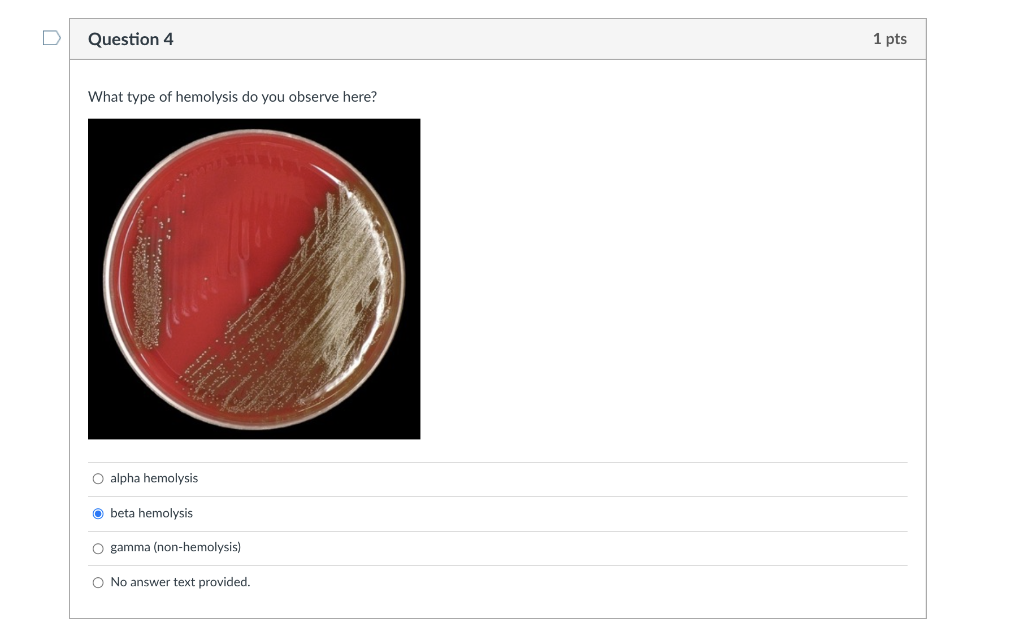 Bloody Urine Mystery Solved Hemolysis Vs Non Hemolysis - jfigiog