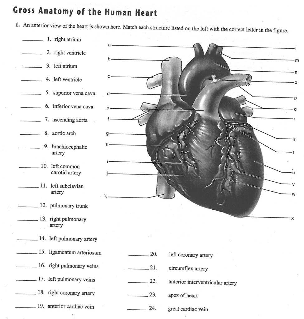 Solved Gross Anatomy Of The Human Heart 1. An Anterior View | Chegg.com