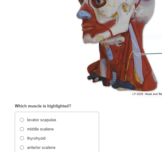 Solved LT CO5 Head and NE Which muscle is highlighted Chegg