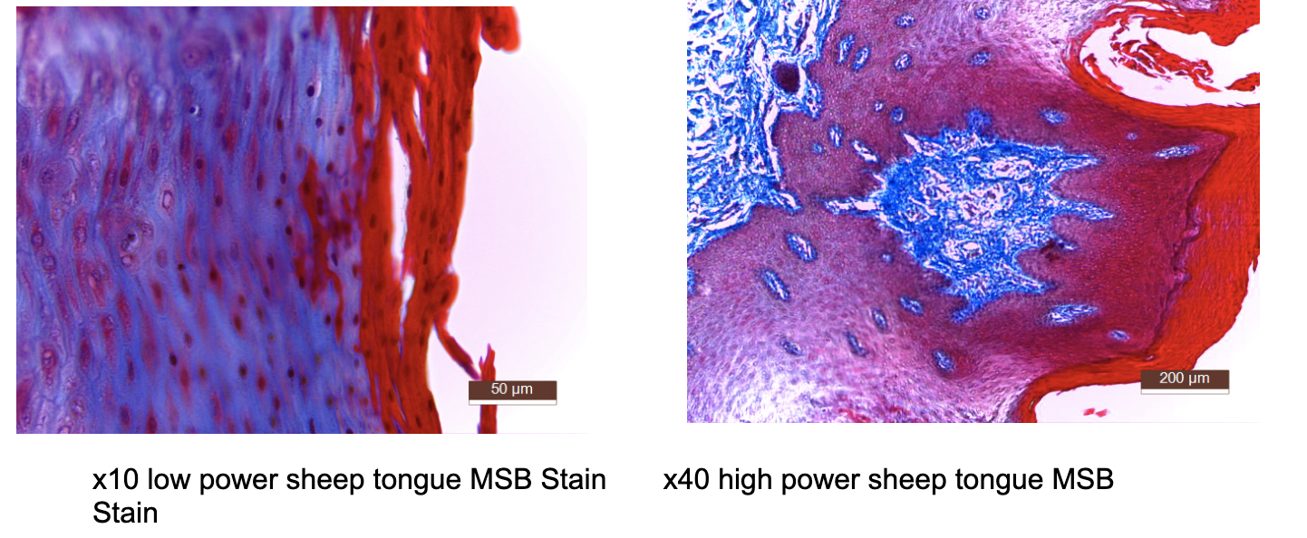 Solved MSB Stain a) Explain why you selected MSB stain for | Chegg.com