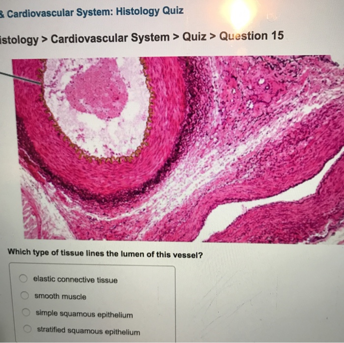 Solved &Cardiovascular System Histology Quiz Istology> C...