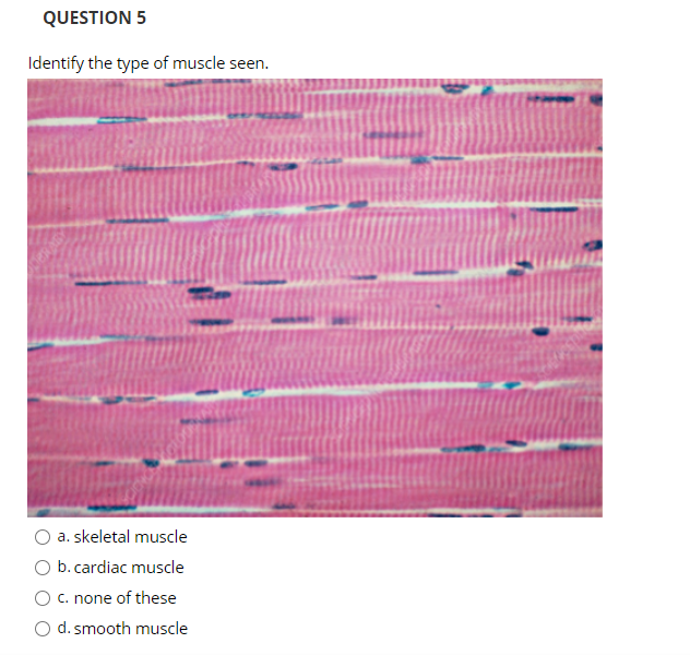 Solved QUESTION 1 IDENTIFY THE TYPE OF CONNECTIVE TISSUE | Chegg.com