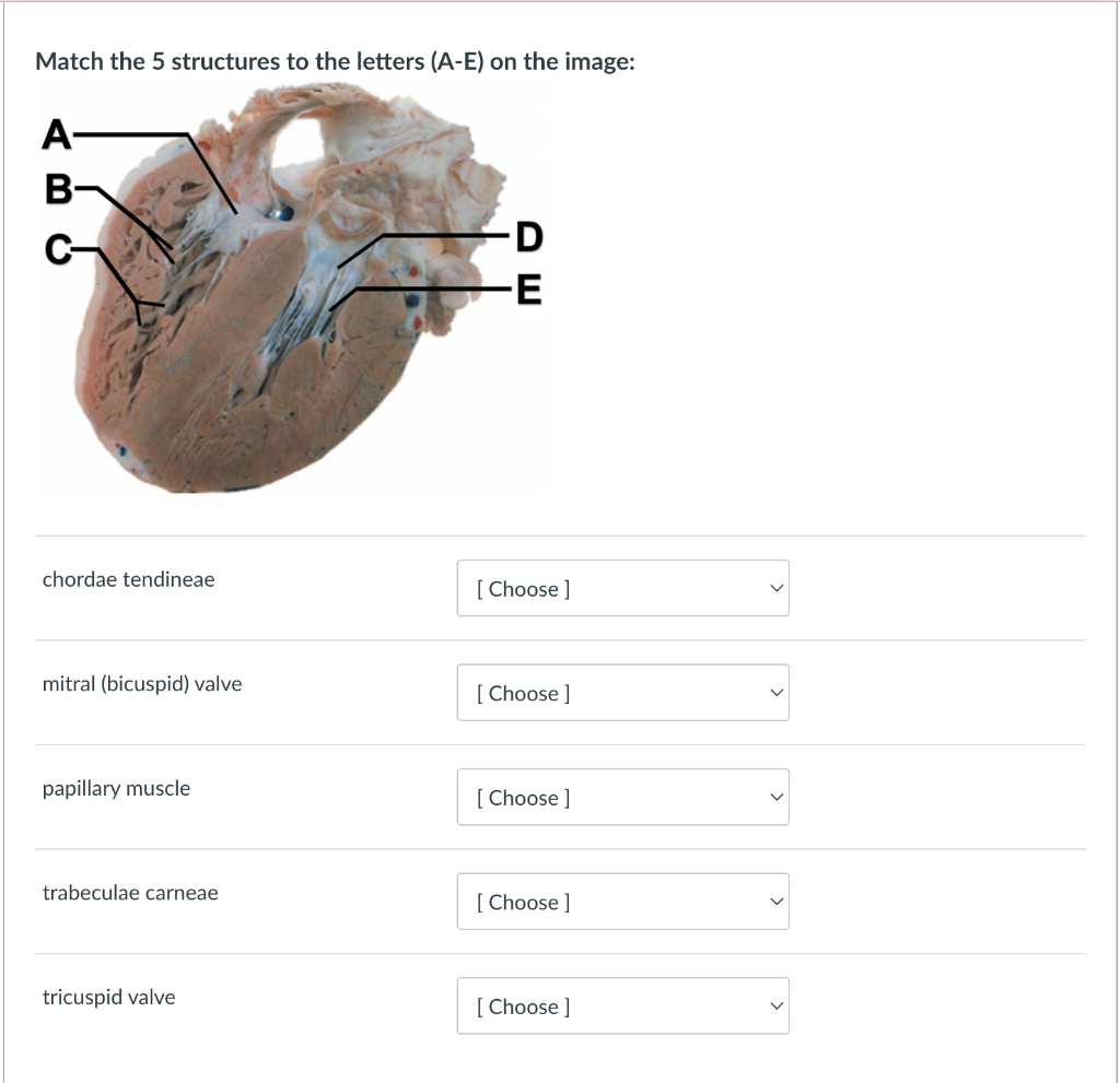 Solved Match the 5 structures to the letters (A-E) on the | Chegg.com