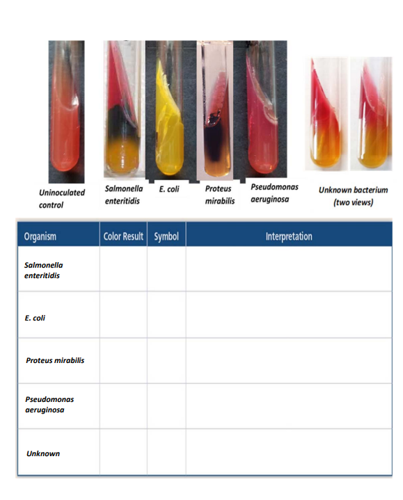 solved-result-interpretation-organism-enterobacter-chegg