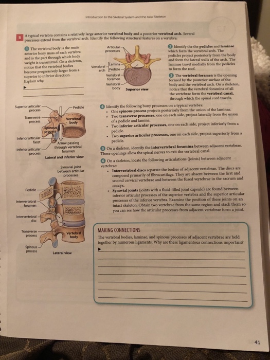 Solved Classifying Bones According to Location Bones can be | Chegg.com