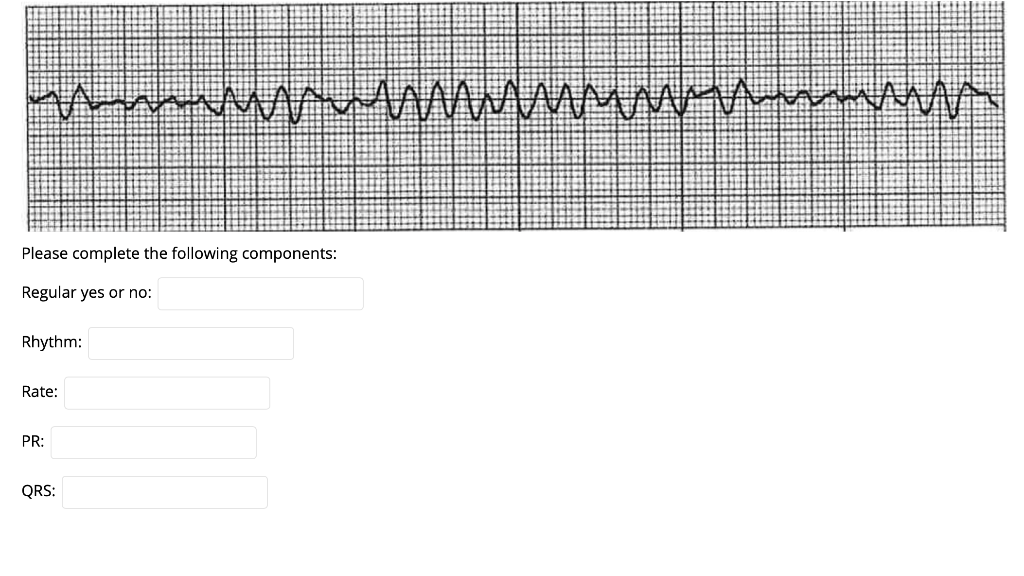 ΑνακΛΛΛΛΛΛΛΛΛΛΛΛΑ man Please complete the following components: Regular yes or no: Rhythm: Rate: PR: QRS: