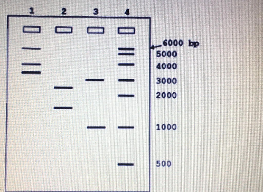 Solved You have performed Restriction Digestion and Gel | Chegg.com