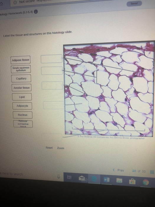 33 Label The Tissues And Structures On This Histology Slide Labels