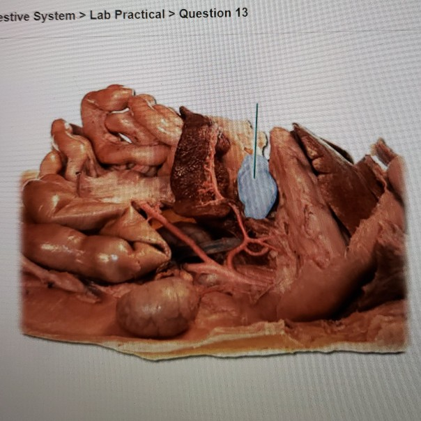 Identify The Highlighted Region Of The Small Chegg Com