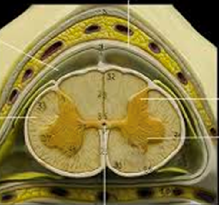 solved-label-dorsal-hornventral-hornlateral-horndorsal-chegg