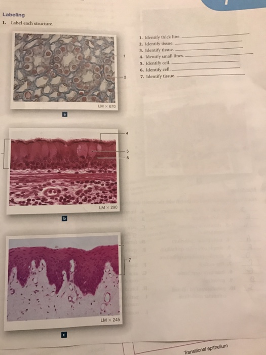 Solved Label each structure. 1. Identify thick line. ______ | Chegg.com