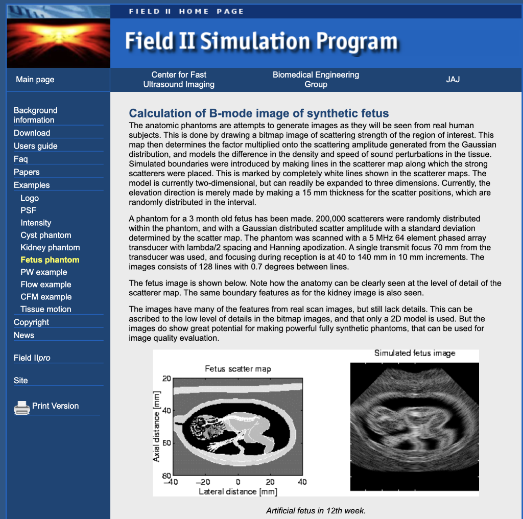 Using MATLAB, simulate an artificial B-mode image using FIELD II stimulation software , feel free to...-2