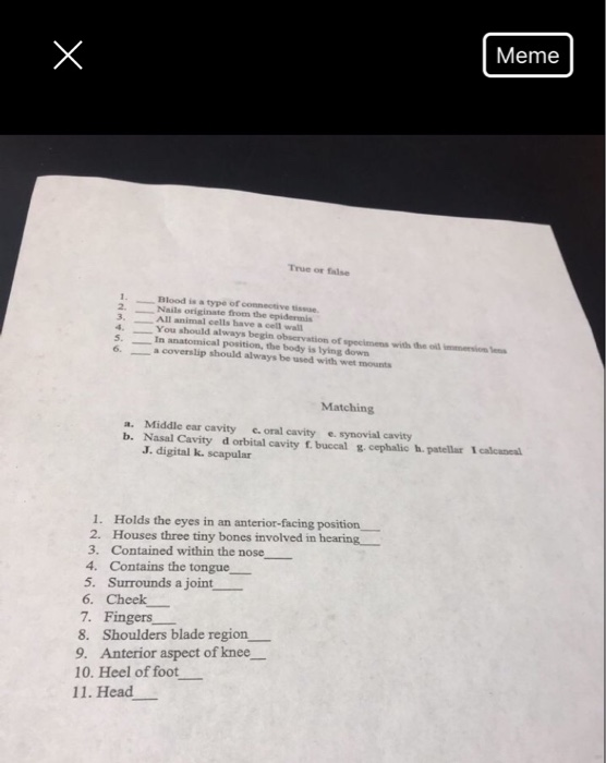 Solved Meme True or false Blood is a type of connective