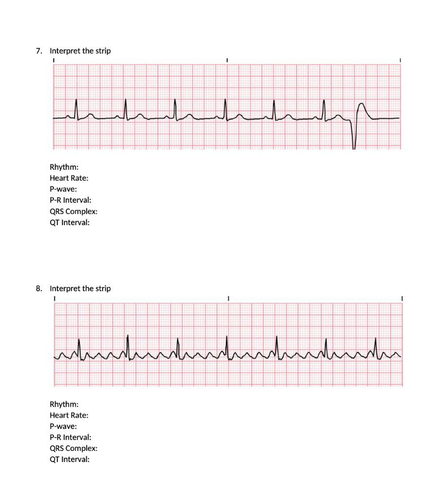 Solved 3. Interpret the strip 4. Rhythm: Heart Rate: P-wave: | Chegg.com