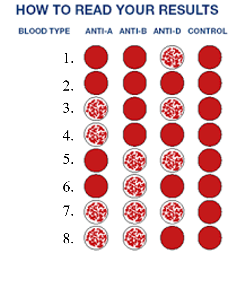 Solved HOW TO READ YOUR RESULTS BLOODTYPE ANTI-A ANTI-B | Chegg.com