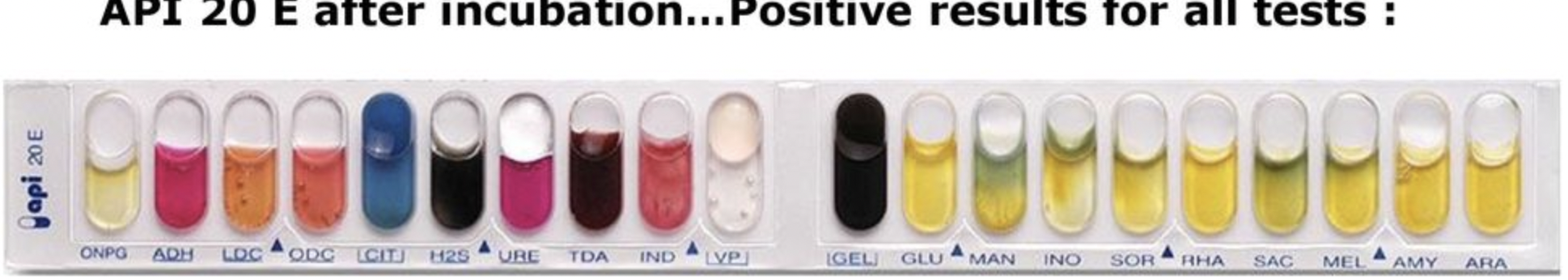 Solved Find all 3 unknowns from API 20 E strip (7 digit code | Chegg.com