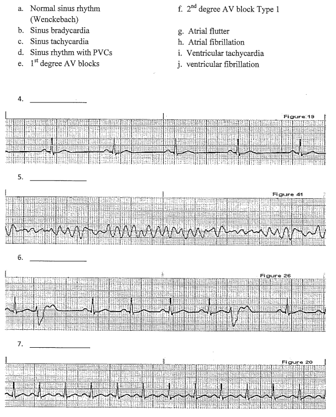 Solved Identify the following rhythm strips by matching the | Chegg.com