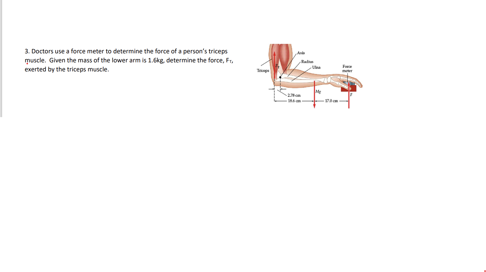 Solved 3. Doctors use a force meter to determine the force