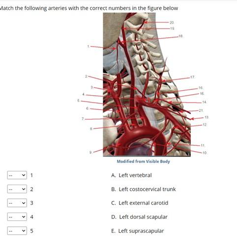 costocervical trunk cadaver