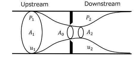 Solved Describe why the flow rate Q is related to the | Chegg.com