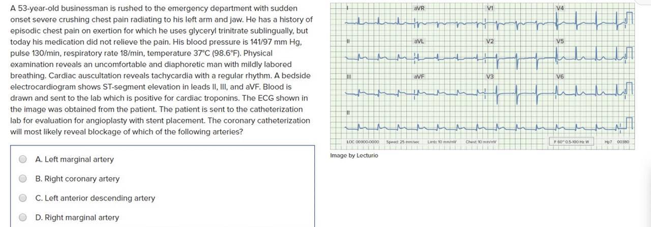 Solved Avr V1 V4 Ih Han Av V2 V5 H A 53-year-old Businessman 