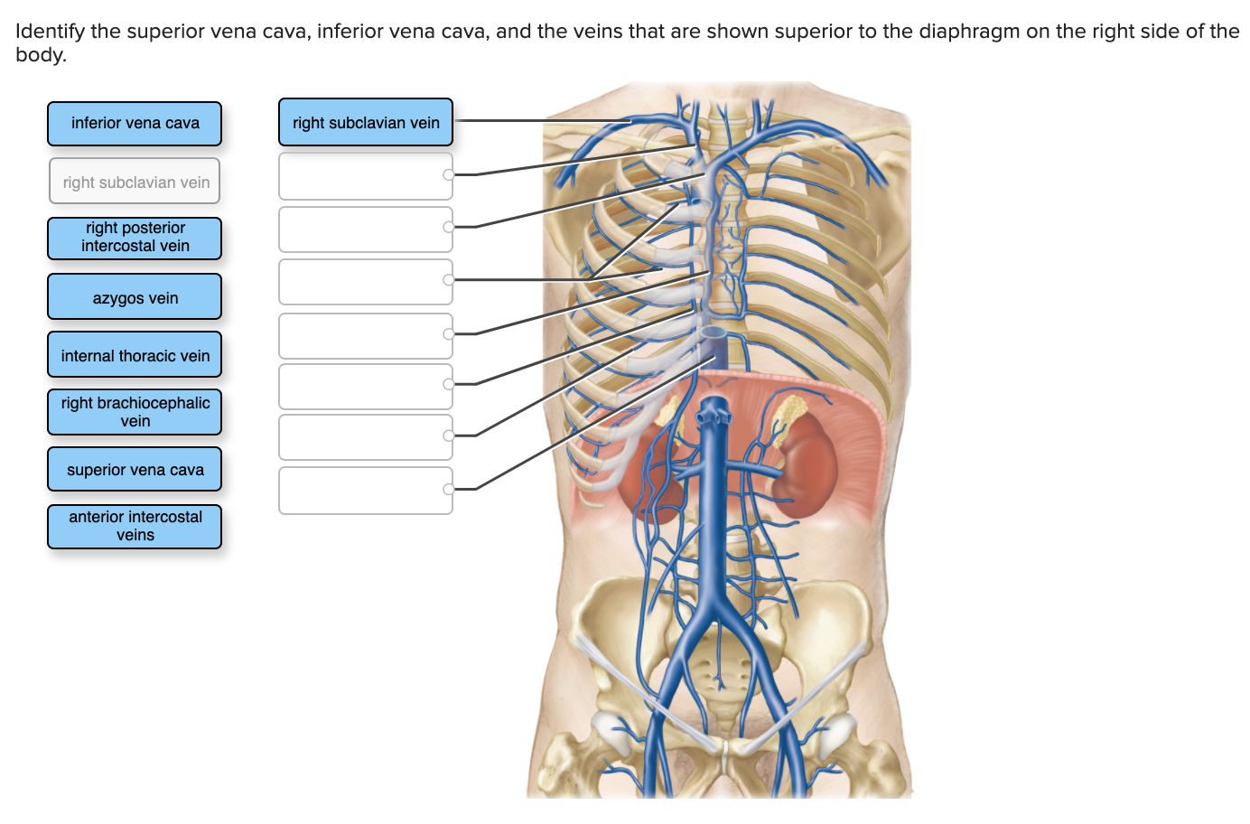 solved-identify-the-superior-vena-cava-inferior-vena-cava-chegg