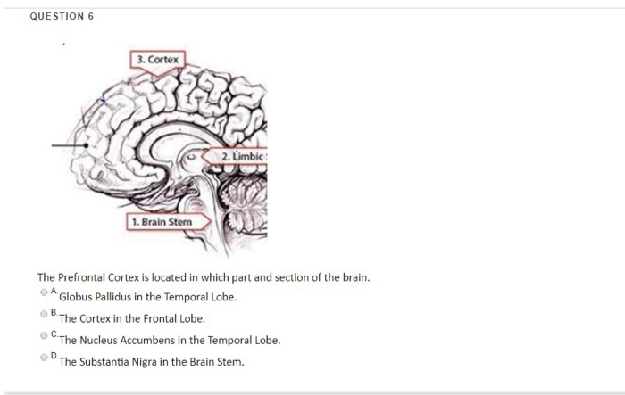 Solved QUESTION 6 3. Cortex 2. Limbic : 1. Brain Stem The | Chegg.com