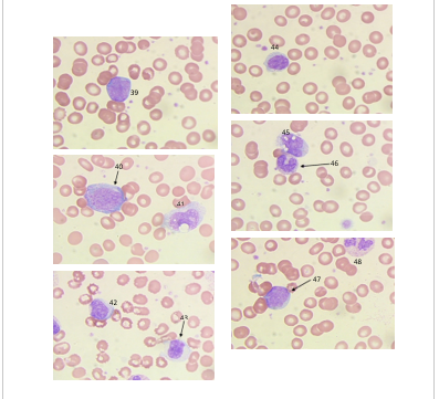 Bonus Questions Bonus 4 When seen on | Chegg.com